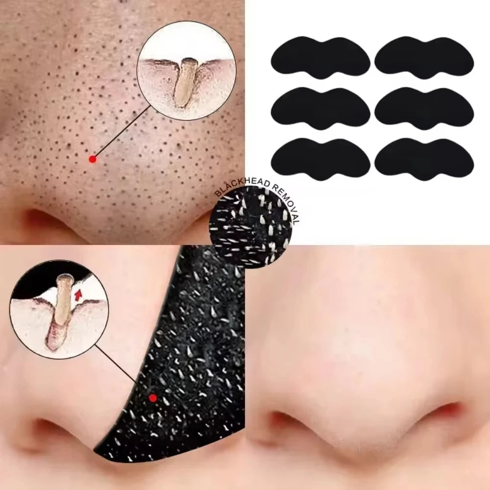 10/50/100 Pieces Blackhead Remover Patches Deep Cleansing - Effective Facial Cleansing to Absorb Facial Blackheads and Pores