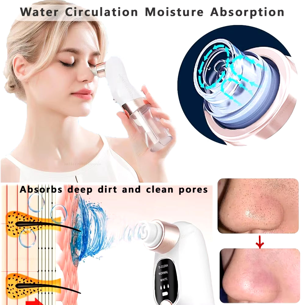 Blackhead Remover Pore Vacuum Face Cleaner Electric Pimple Acne Black Head Removal USB Rechargeable Water Cycle Black Dot Remove